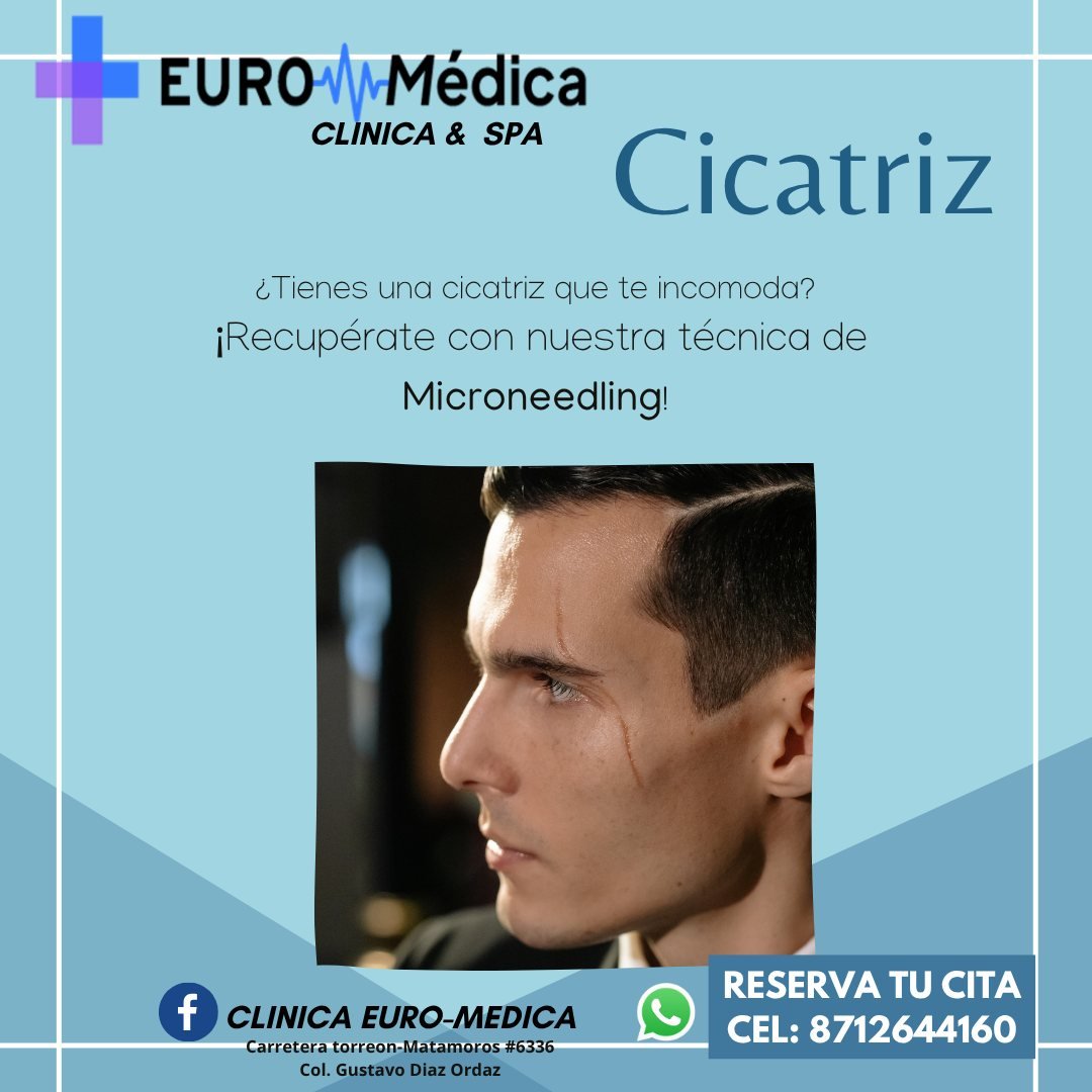Microneedling SPA